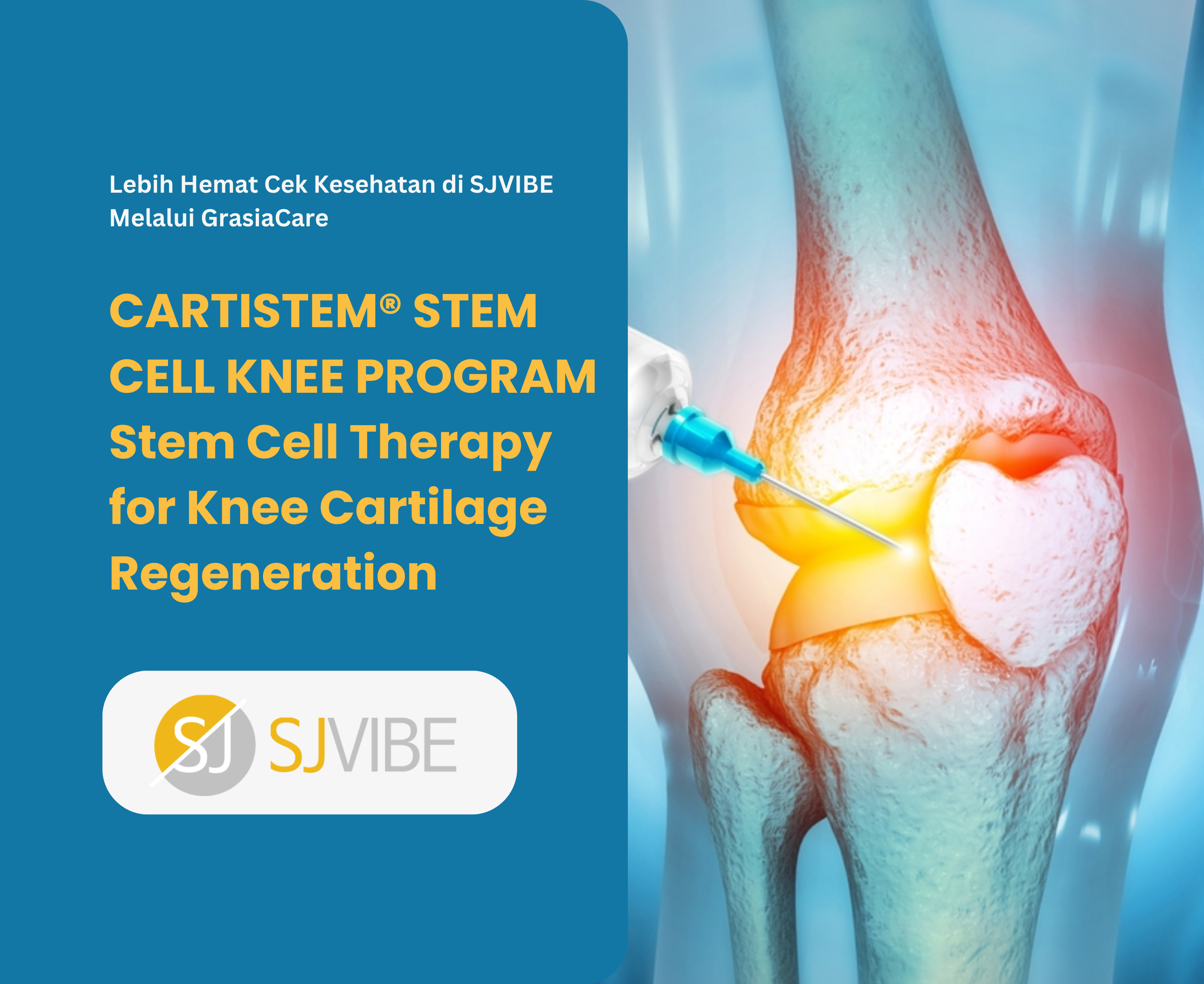CARTISTEM® STEM CELL KNEE PROGRAM Stem Cell Therapy for Knee Cartilage Regeneration