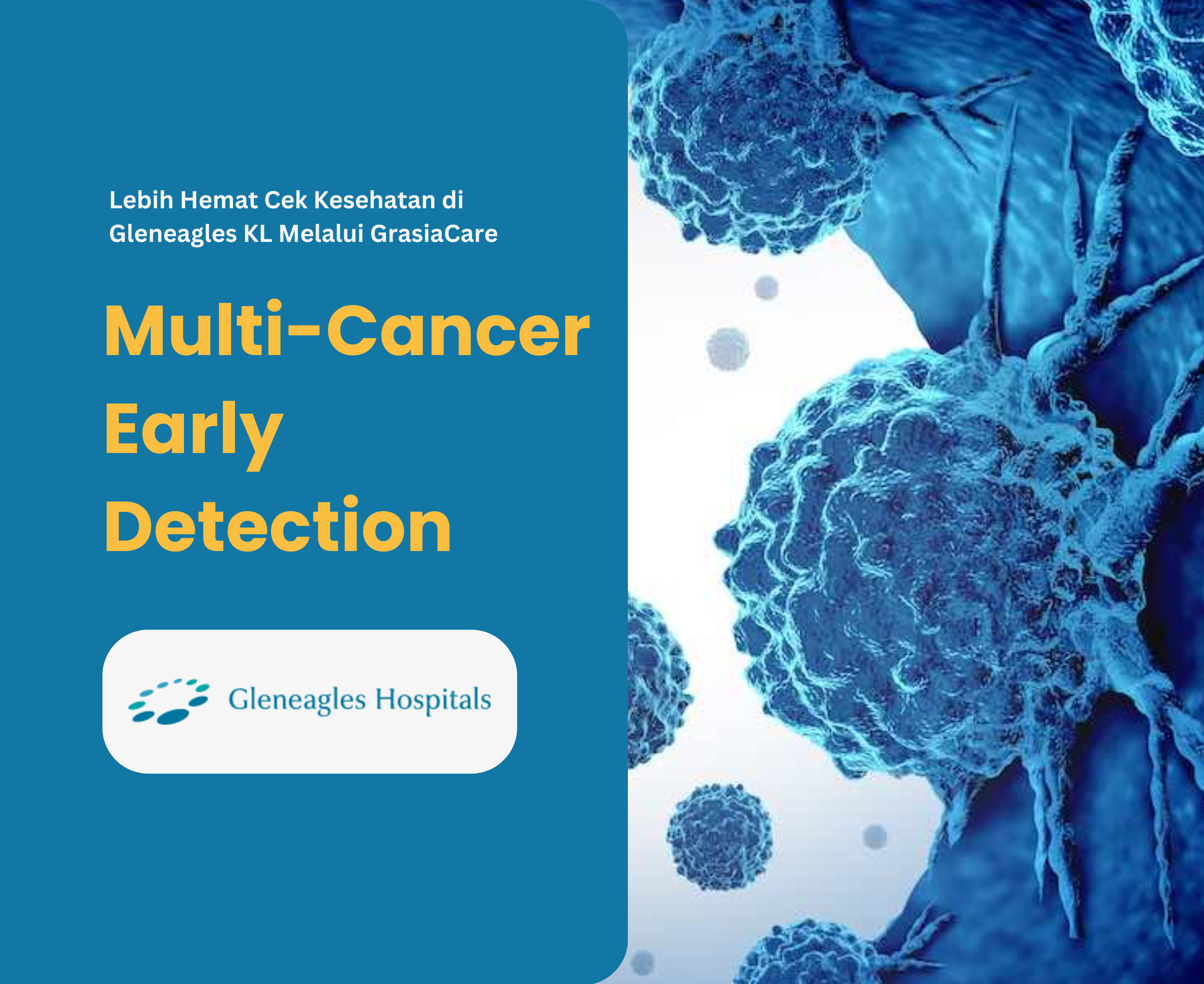 Multi-Cancer Early Detection